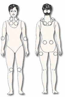 Figura 1: Los puntos de esta figura indican los diferentes sitios de los “puntos dolorosos”.